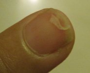 broken nail.JPG